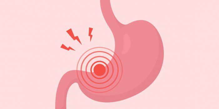 stomach pain gastritis, indigestion, heartburn vector illustration of human internal organ