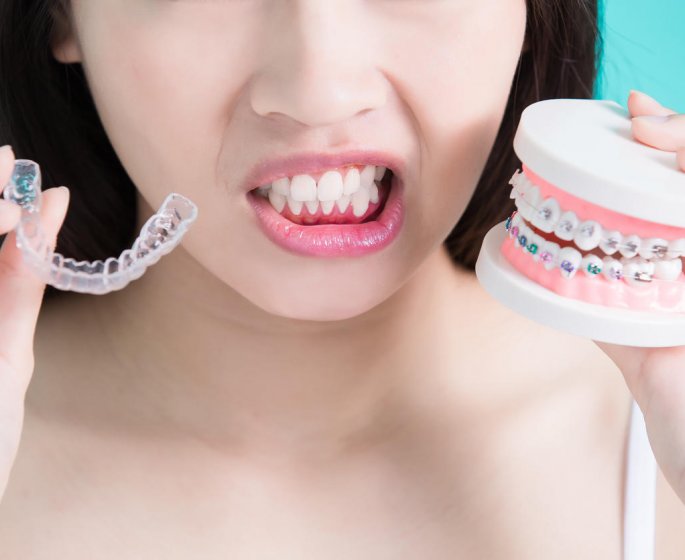 Transparent, amovible, gouttiere... Comment choisir son appareil dentaire ?