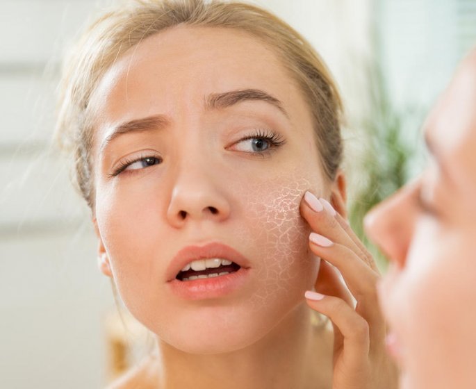 Demangeaisons : une peau seche peut etre un signe d-allergie