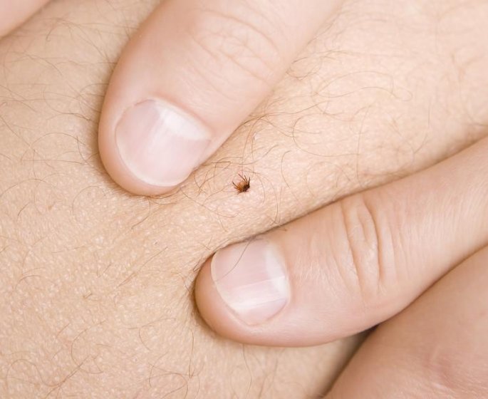 Maladie de Lyme : comment prevenir les morsures de tiques ?