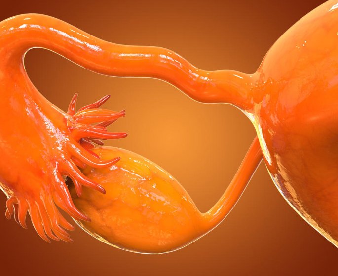 Cancer des ovaires : les personnes les plus a risques
