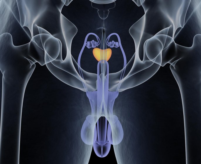 Prostate : les operations possibles 