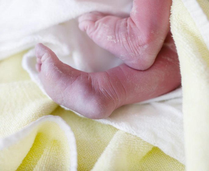 Un bebe recoit six points de suture apres un coup de scalpel pendant une cesarienne