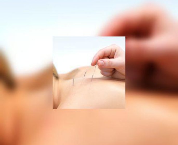 Radiotherapie de la tete et du cou : prevenir l’effet « bouche seche » grace a l’acupuncture
