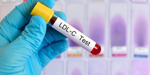 Taux de cholesterol : pourquoi surveille-t-on le LDL ?