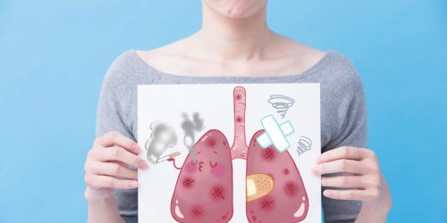 Le cancer du poumon progresse vite chez les femmes