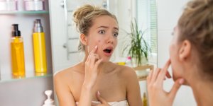 L’acne des adultes : quand l’acne joue les prolongations