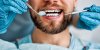 Mauvaise santé bucco-dentaire : moins de chances de survivre à un cancer ORL