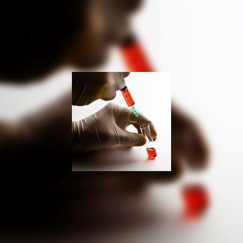 Maladie de Hodgkin, un cancer des organes lymphatiques