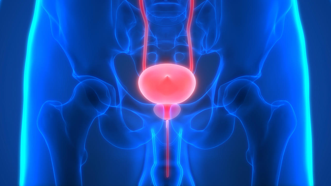 Prostatite et cancer de la prostate : existe-t-il un lien ?