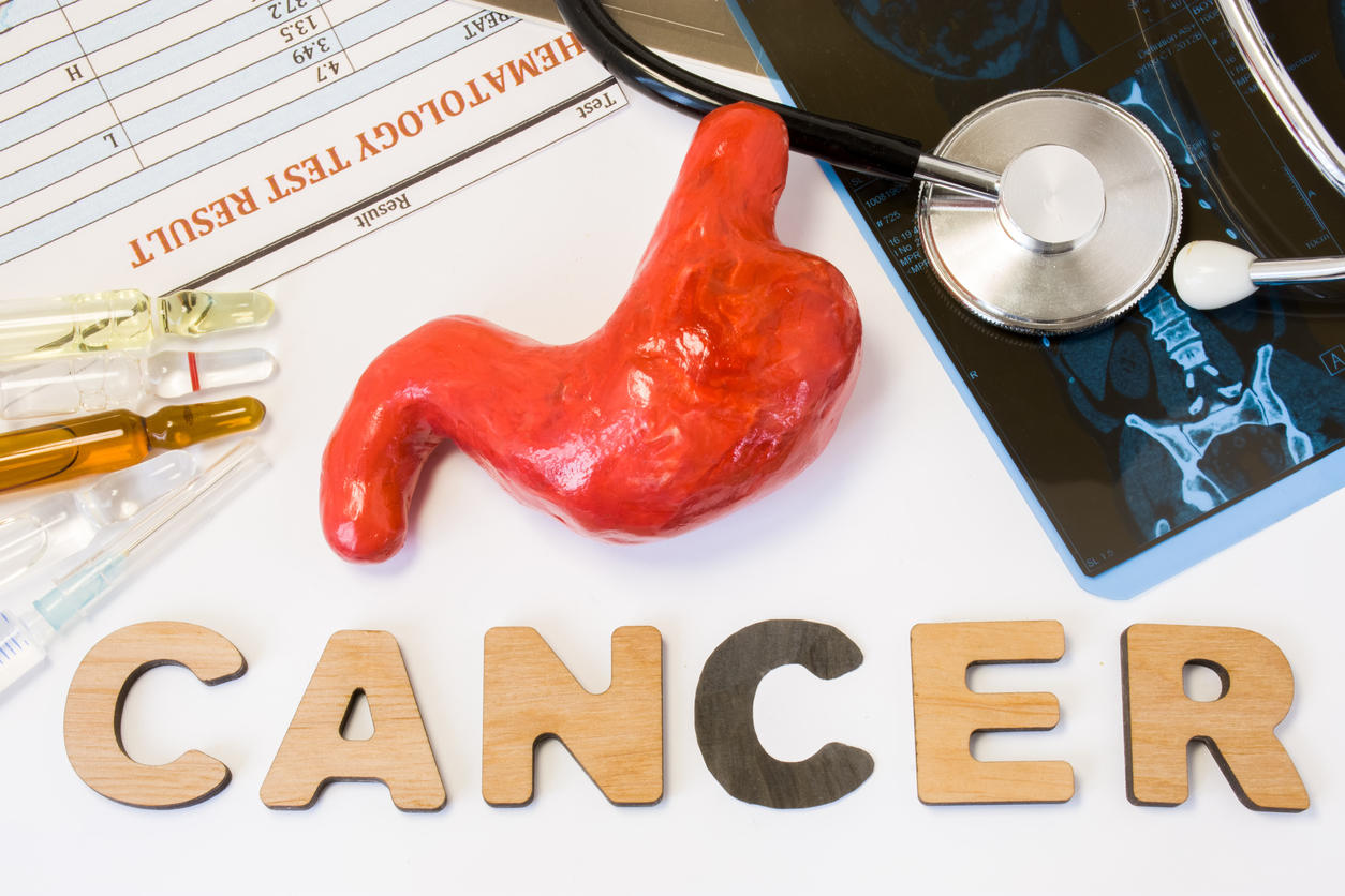 Cancer De La Peau Stade 3 Chance De Survie Communauté MCMS