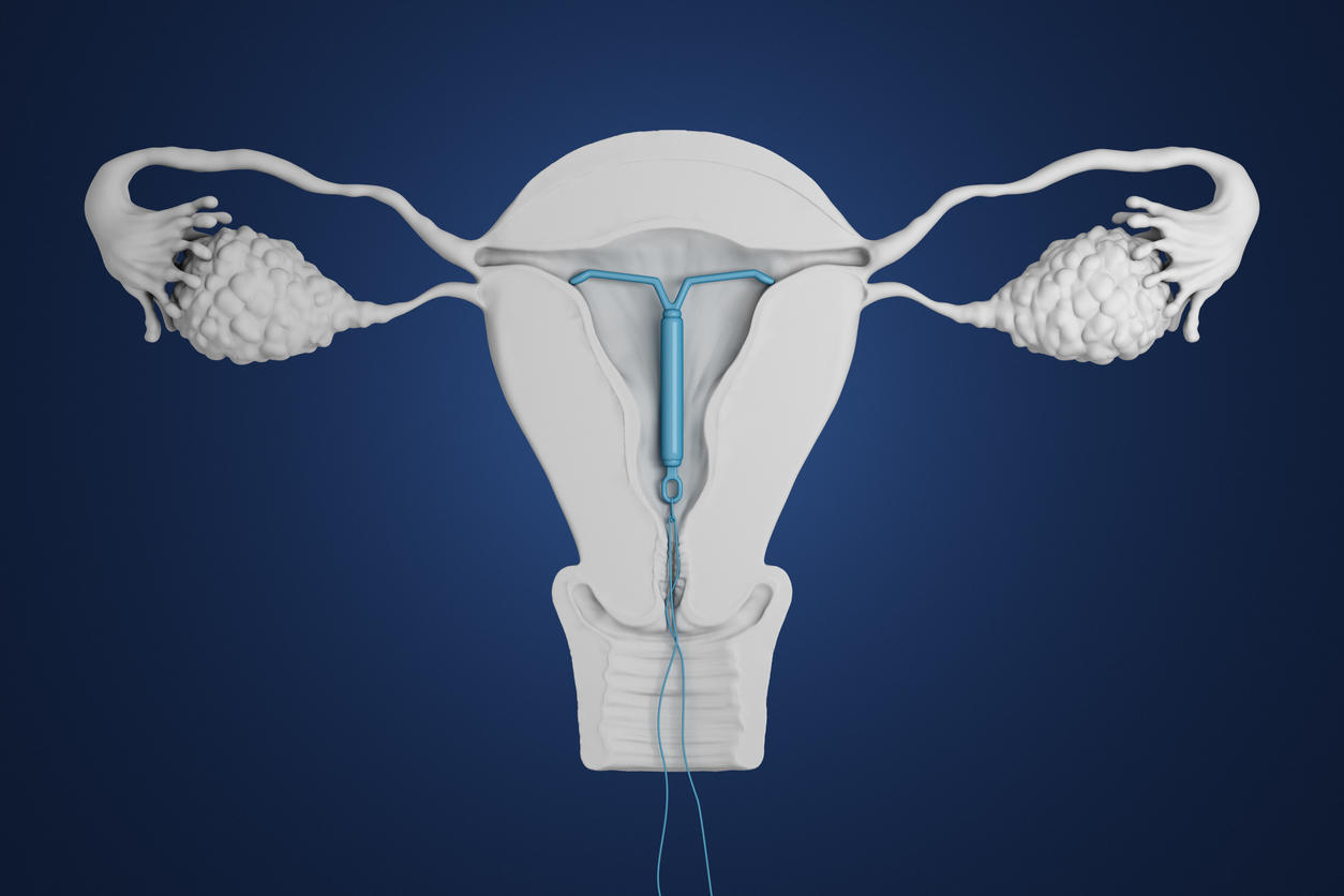 Fasciner Vacances Pendant syndrome prémenstruel sterilet cuivre Identifiants régiment Talent