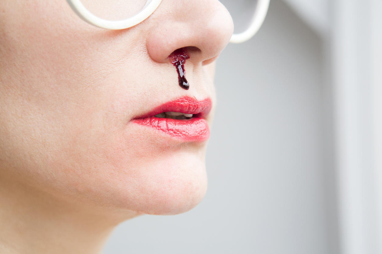 Que faire… si je saigne du nez ? : Femme Actuelle Le MAG