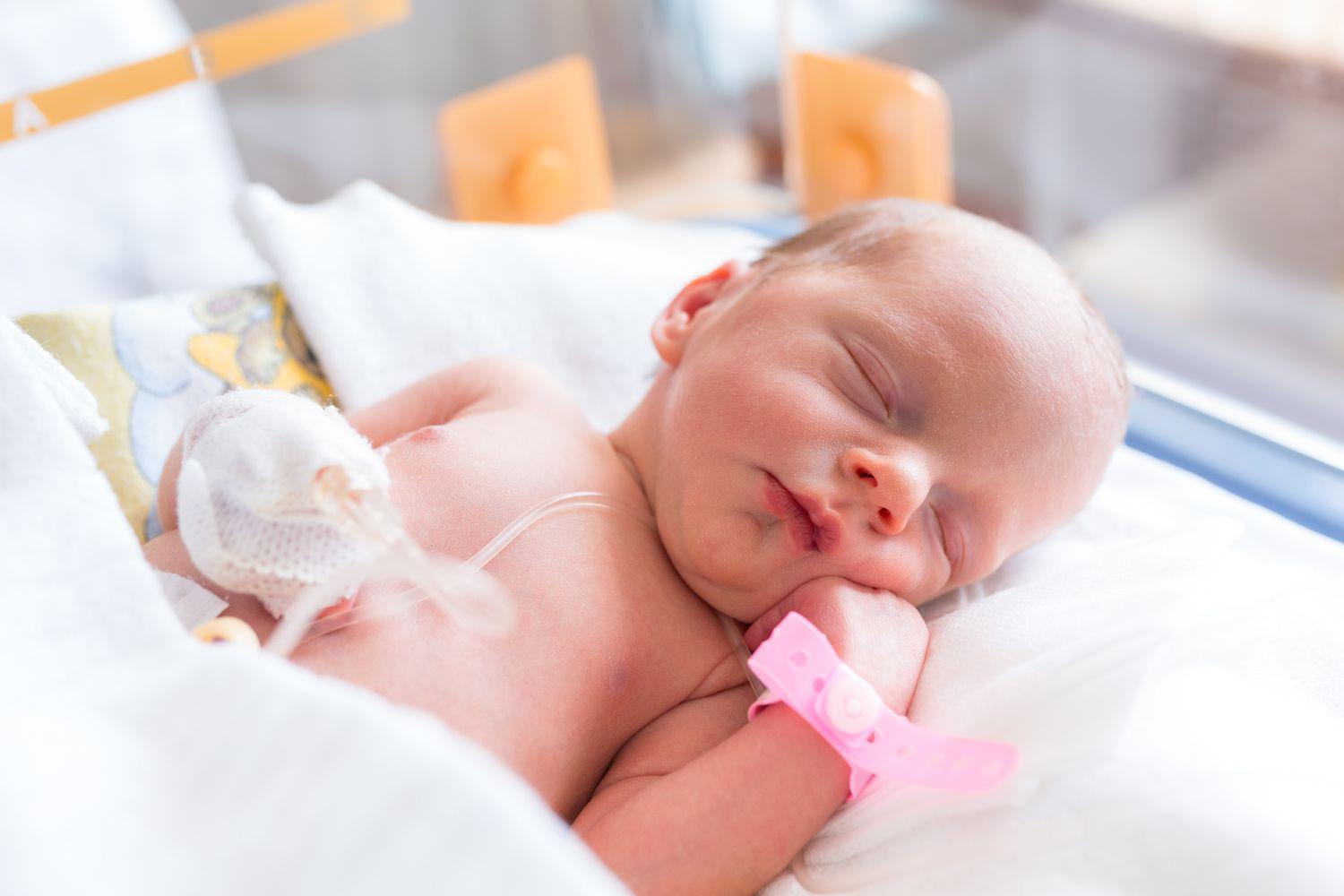 Un Bebe Opere Du Mauvais Cote Dans Un Hopital En France
