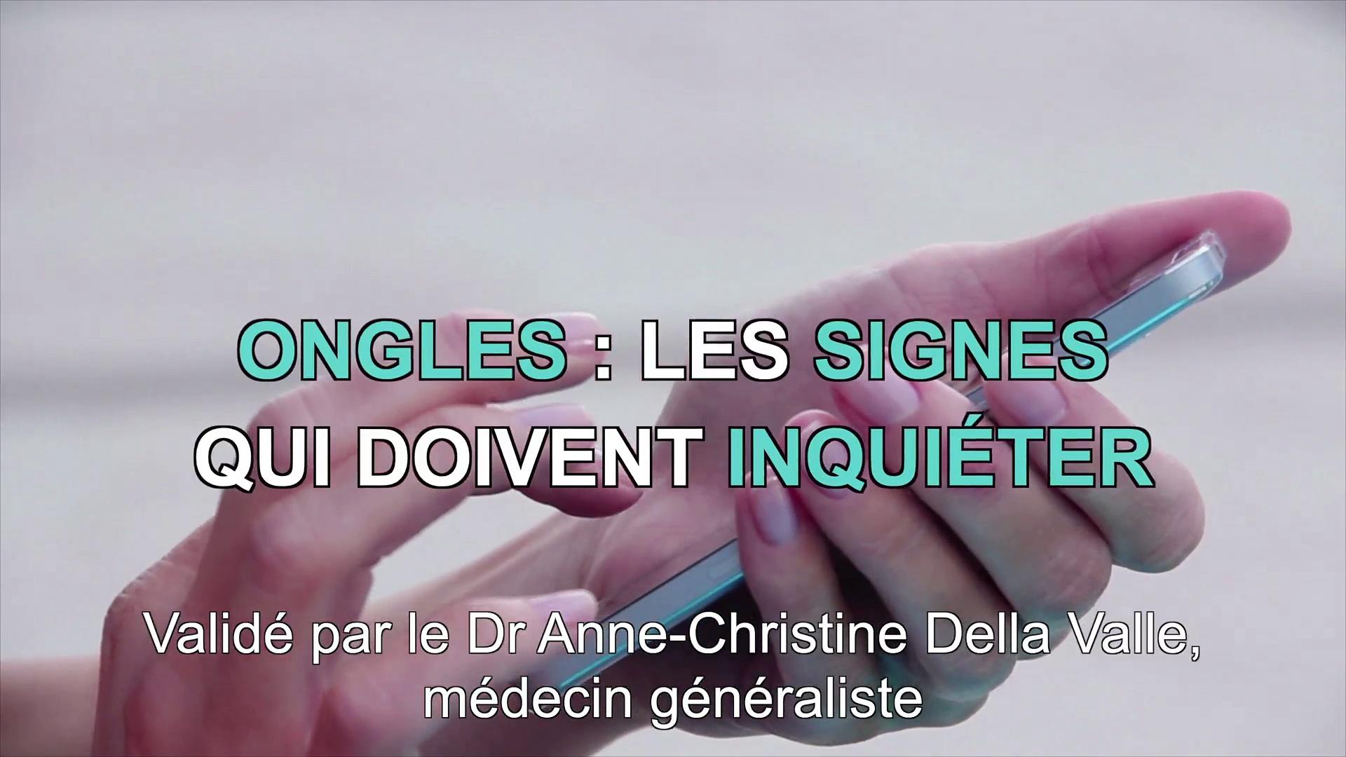 Ongles Jaunes 15 Astuces Miracles Pour Les Blanchir
