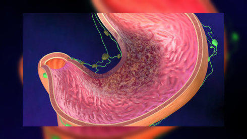 Cancer de l'estomac: symtômes du cancer de l'estomac