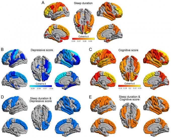 Image des effets du manque de sommeil sur les différentes zones du cerveau d’un enfant