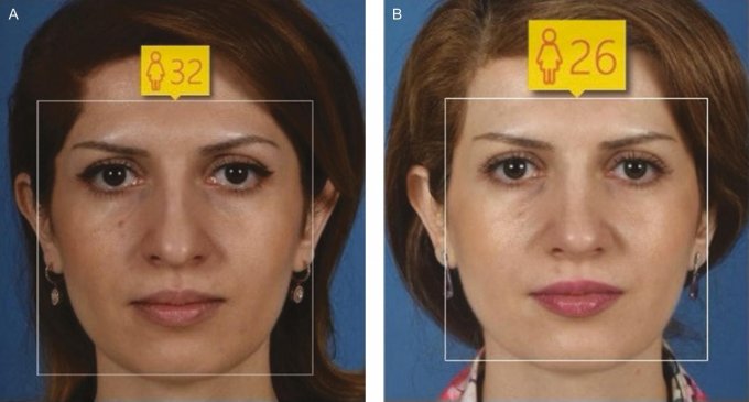 Les photos avant/après étudiée par l&apos;intelligence artificielle