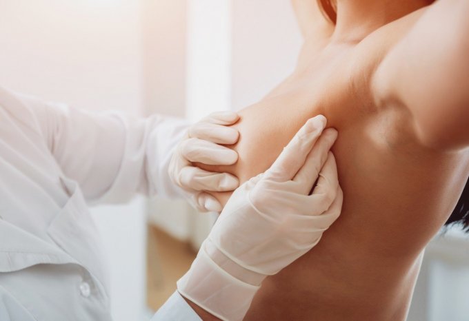 La pose d’implants mammaires augmente-t-elle les risques de cancer du sein ? 