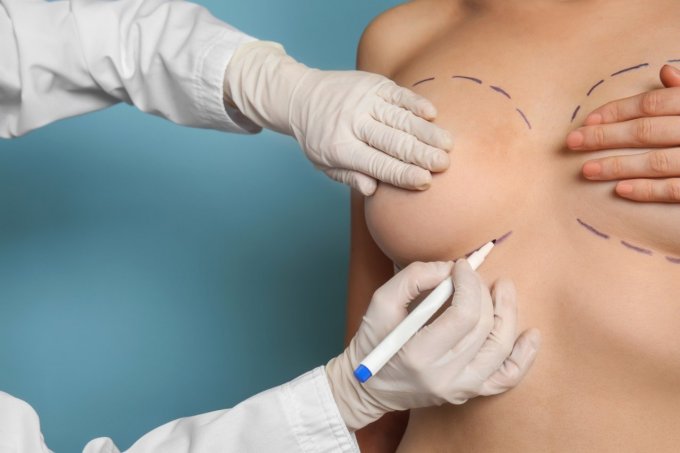 Prothèses mammaires : les complications possibles