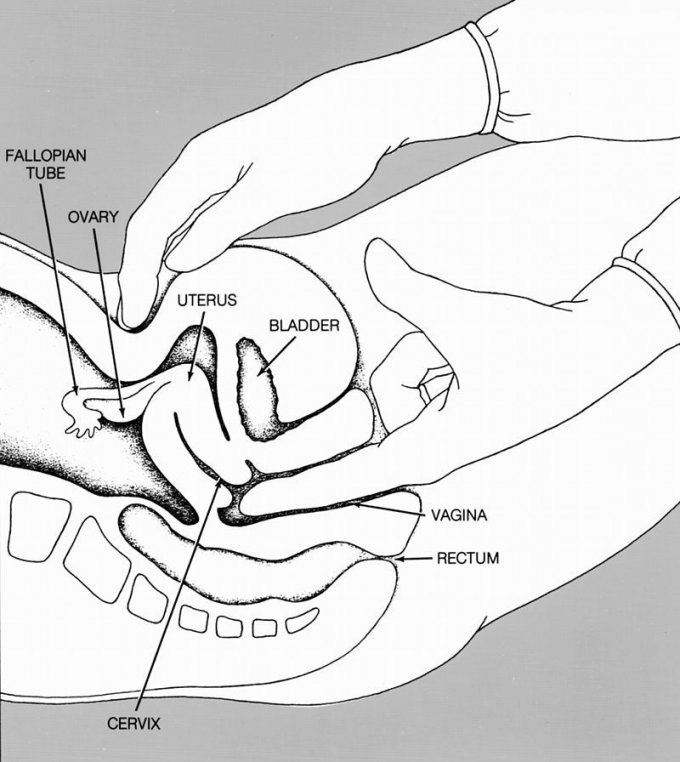 Schéma du déroulement l&apos;examen pelvien