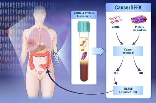 Tr&egrave;s efficace pour le cancer de l'ovaire