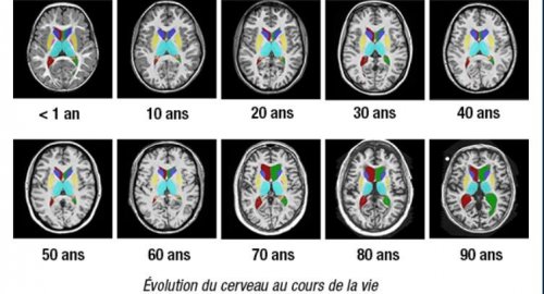 Un coup dur pour le cerveau des hommes