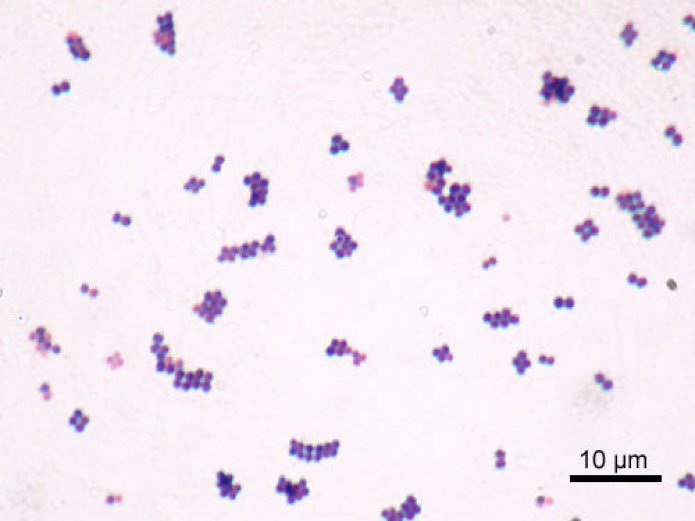 Image au microscope de staphylocoques dorés