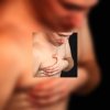 Tuberculose