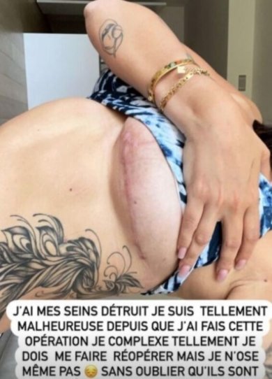 [Photo] Jelena Dukic, victime de la chirurgie esthétique : “j’ai mes seins détruits”