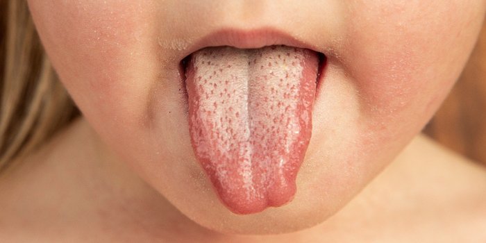 5 indicateurs que votre langue donne sur votre santÃ©