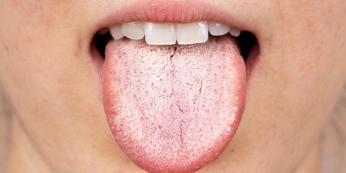 5 indicateurs que votre langue donne sur votre santÃ©