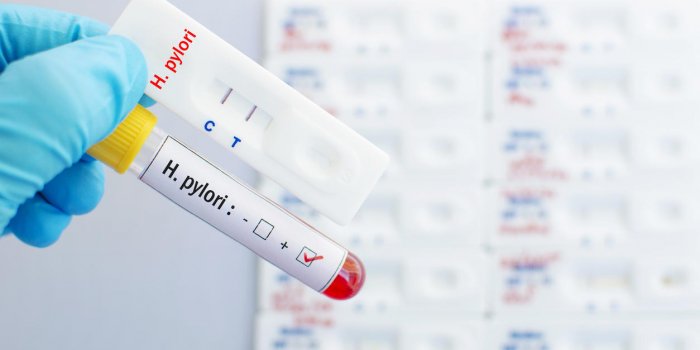 Cancer de lâestomac : 7 facteurs qui vous mettent à risque