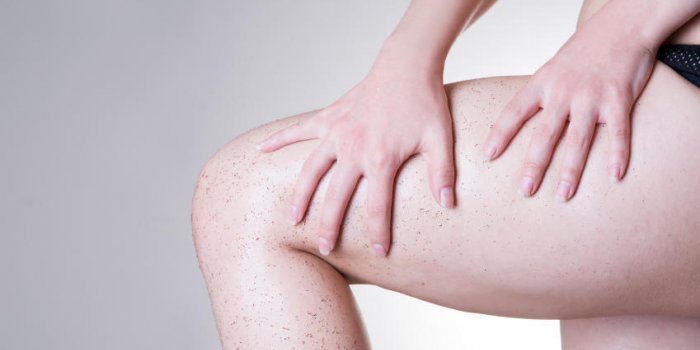 Les 5 symptÃ´mes de la maladie des "jambes poteaux"