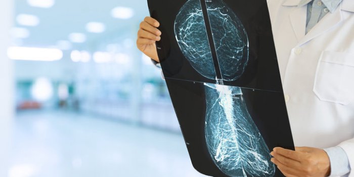 Cancer du sein : 10 gestes simples pour le prévenir