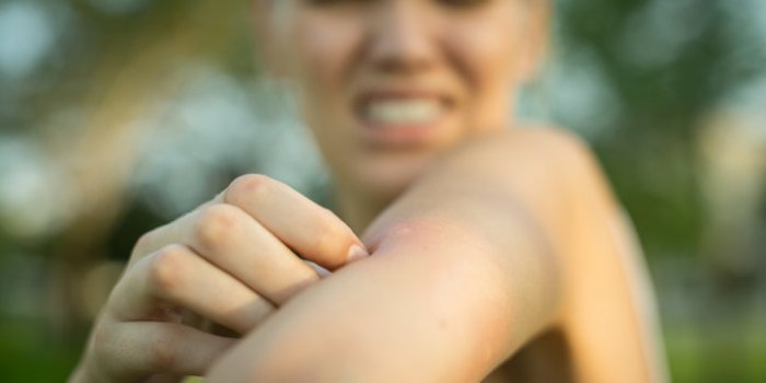 Tiques : 10 erreurs à ne plus faire pour éviter les morsures