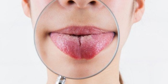 Taches sur les mains, langue gonflée, brûlures⦠les signes de la covid-19 méconnus