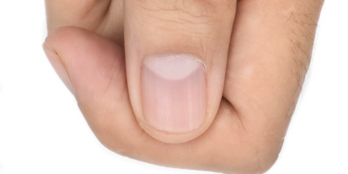 Ongle Covid : 5 signes que vous avez été infectés par le coronavirus