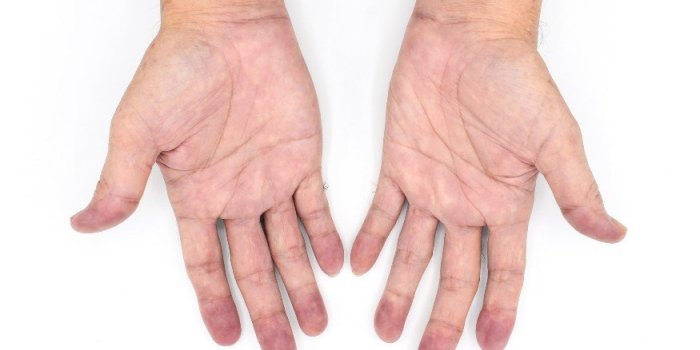 Insuffisance respiratoire : 9 signes à repérer