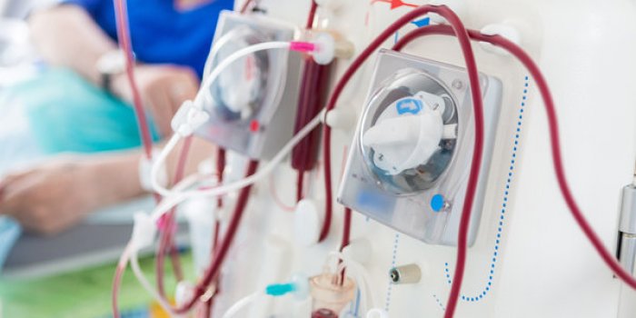 Cancer du rein : 9 facteurs de risques à connaître