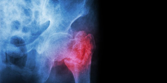 La ménopause augmente les risques de syndrome métabolique