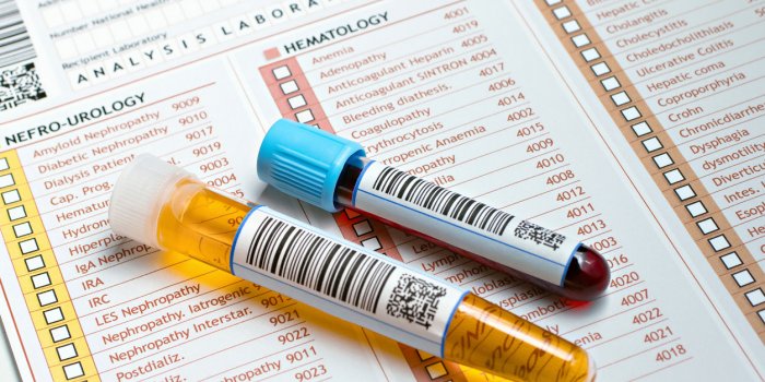 Cancer du rein : 8 signes qui doivent alerter