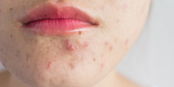 10 signes que vous avez un dÃ©rÃ¨glement hormonal