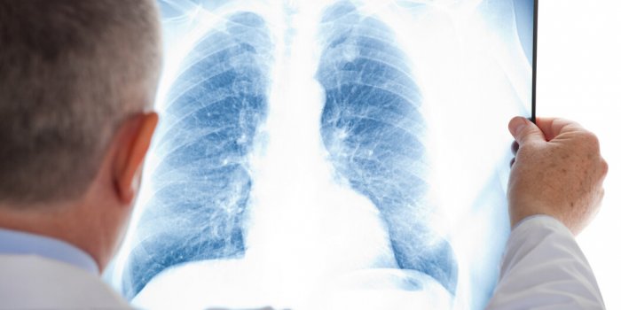 Cancer : ces 5 dépistages négligés par les hommes