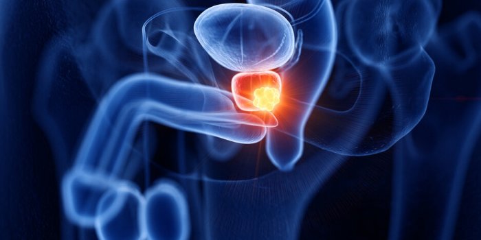 Cancer : ces 5 dépistages négligés par les hommes