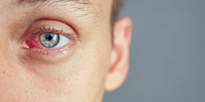 Bouche sèche : 5 pathologies graves quâelle peut révéler