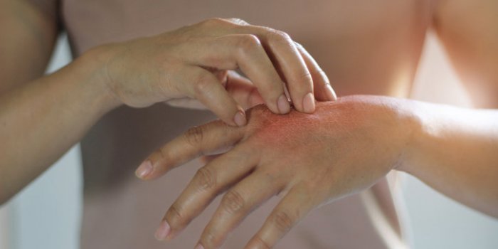 Covid long : elle contracte la covid et présente plus de 100 symptômes