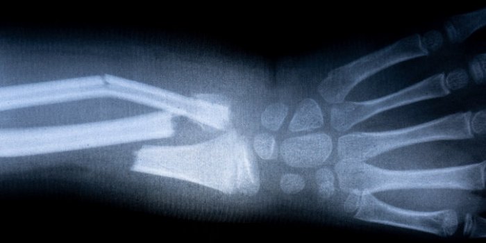 Cancer du sang : les symptômes à repérer