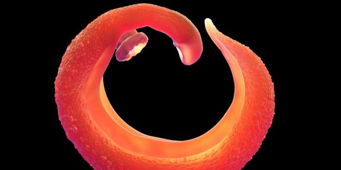 Cancer de la vessie : 6 facteurs de risque à identifier