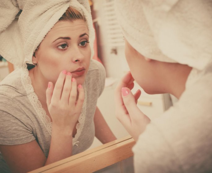 Acne : quand passer aux medicaments ?